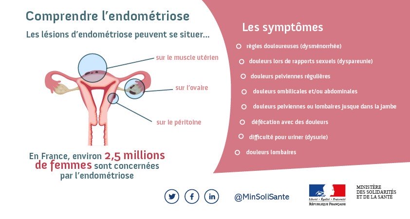 Semaine européenne de l'endométriose – 2 au 8 Mars 2020 – Clinique ...